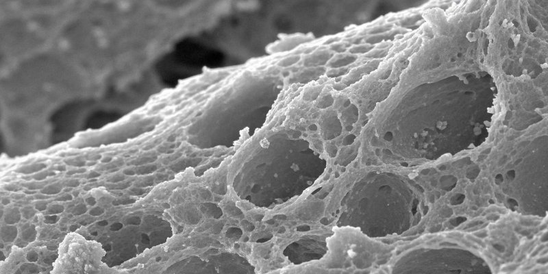 Polyolefin Battery Separator Microscopic view of a porous battery separator material